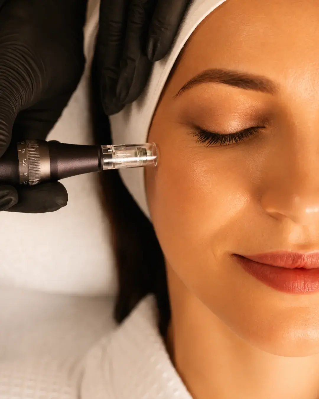 Tratamiento PRP + PDRN Facial en Albanta Aesthetic Spa